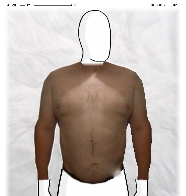Picture 1