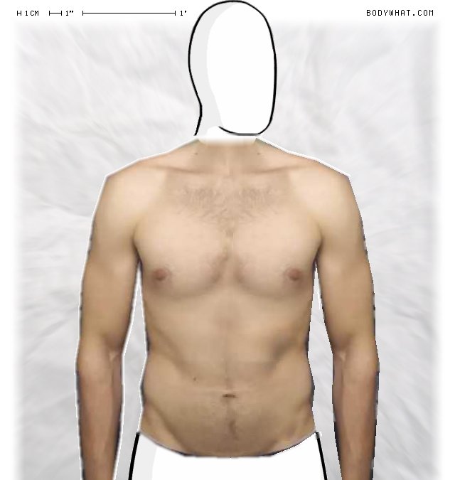 Picture 1