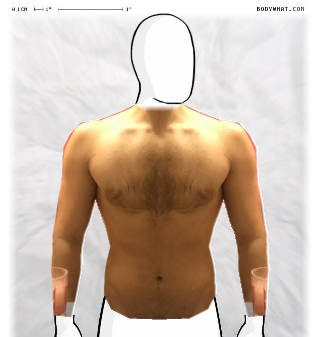Picture 1