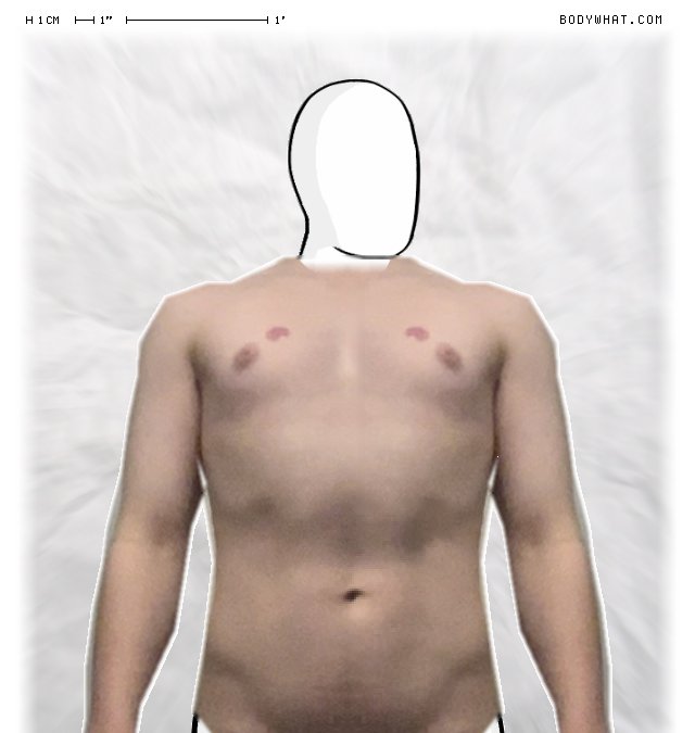 Picture 1