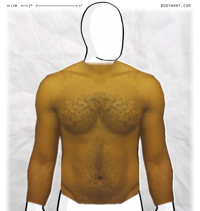 Picture 1