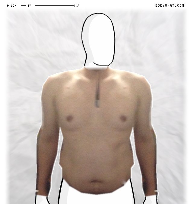 Picture 1